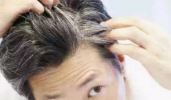 反转了？早早长白头发，不是未老先衰，而是为了对抗痴呆？