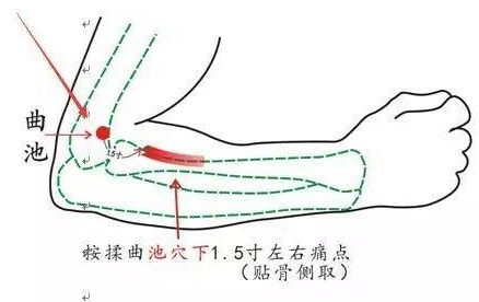 曲池穴