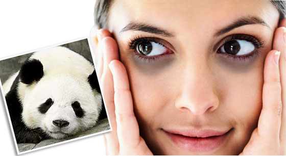 熊猫眼该如何消除？ 